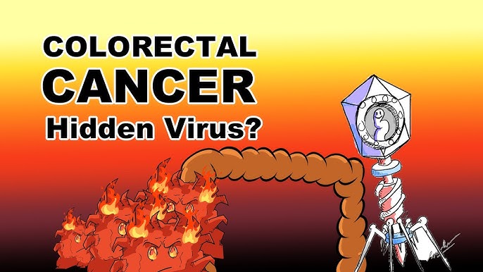 virus inside gut bacteria and colorectal cancer